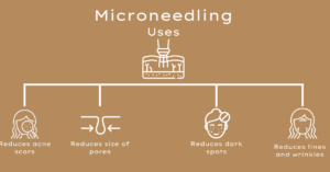 a uses and benefits of microneedling cartoon image with a beige background