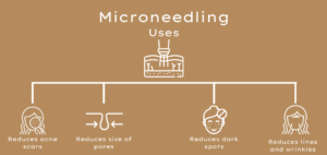 a uses and benefits of microneedling cartoon image with a beige background