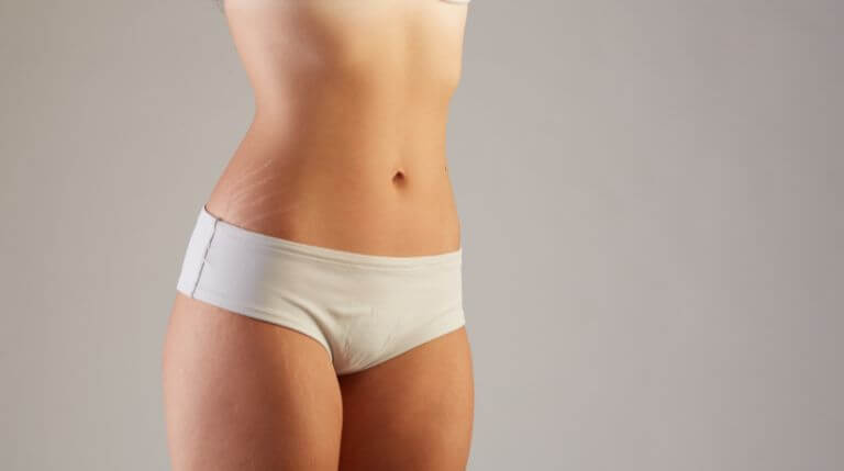 Does Laser Fat Reduction Really Work?